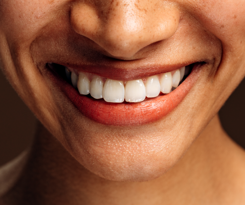 Aesthetic dentistry